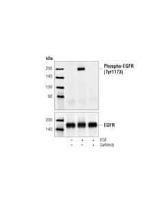 Cell Signaling Gefitinib