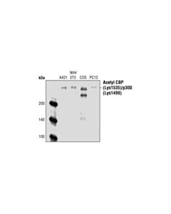 Cell Signaling Acetyl-Cbp (Lys1535)/P300 (Lys1499) Antibody