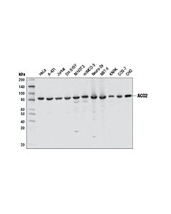 Cell Signaling Tricarboxylic Acid Cycle Antibody Sampler Kit