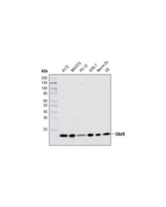 Cell Signaling Ubc9 (D26f2) Xp Rabbit mAb
