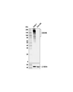 Cell Signaling Cd248 (E9z7o) Xp Rabbit mAb