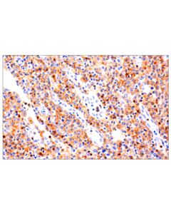 Cell Signaling CD4 (EP204) Rabbit mAb