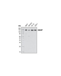 Cell Signaling Hausp (D17c6) Xp Rabbit mAb