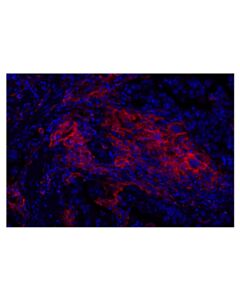 Cell Signaling CD206/MRC1 (E2L9N) Rabbit mAb (Alexa Fluor® 555 Conjugate)
