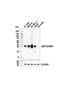 Cell Signaling Gdf15/Mic1 (E4d3k) Rabbit mAb