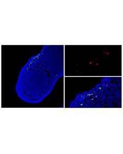 Cell Signaling Tunel Assay Kit (Fluorescence, 594 Nm)