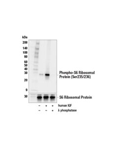 Cell Signaling Phospho-S6 Ribosomal Protein (Ser235/236) (D57.2.2e) Xp Rabbit mAb