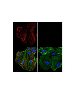 Cell Signaling Mthfd2 (E7a4l) Xp Rabbit mAb (Alexa Fluor 594 Conjugate)