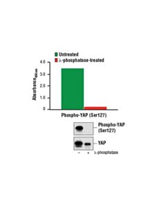Cell Signaling Pathscan Phospho-Yap (Ser127) Sandwich ELISA Kit