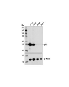 Cell Signaling P53 (Do-7) Mouse mAb