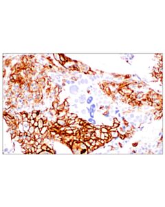 Cell Signaling Cd11b/Itgam (E3j2f) Rabbit mAb