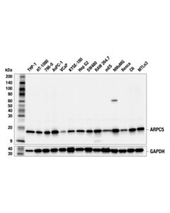 Cell Signaling ARPC5 (F5F6V) Rabbit mAb 20 uL