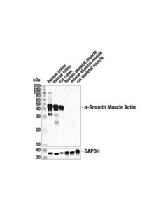 Cell Signaling alpha-Smooth Muscle Actin (1A4) Mouse mAb (IF Formulated) 20 uL