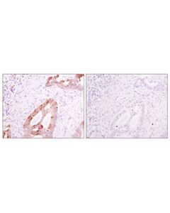 Cell Signaling Rabbit (DA1E) mAb IgG XP Isotype Control (BSA and Azide Free)