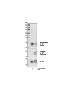 Cell Signaling Non-Phospho-4e-Bp1 (Thr46) (87d12) Rabbit mAb