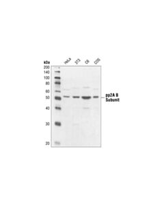 Cell Signaling Pp2a B Subunit Antibody