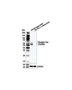 Cell Signaling Phospho-Tau (Thr205) (E7D3E) Rabbit mAb 20 uL