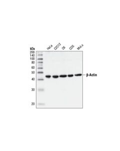 Cell Signaling Beta-Actin Antibody