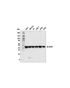 Cell Signaling Beta-Actin (13e5) Rabbit mAb