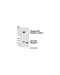 Cell Signaling Phospho-Vegf Receptor 2 (Tyr951) (15d2) Rabbit mAb