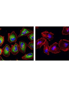 Cell Signaling Phospho-S6 Ribosomal Protein (Ser240/244) (D68f8) Xp Rabbit mAb (Alexa Fluor 488 Conjugate)