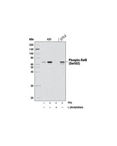 Cell Signaling Phospho-Relb (Ser552) (D41b9) Xp Rabbit mAb