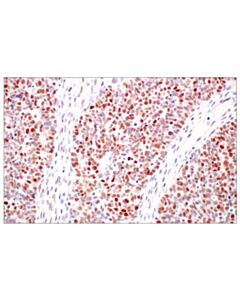 Cell Signaling Dnmt1 (D63a6) Xp Rabbit mAb