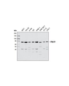 Cell Signaling Erp72 (D70d12) Xp Rabbit mAb