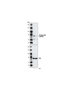 Cell Signaling Phospho-Btk (Tyr223) Antibody