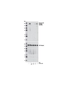 Cell Signaling Erlotinib