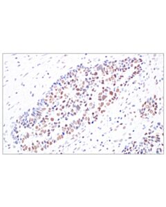 Cell Signaling Hdac2 (3f3) Mouse mAb