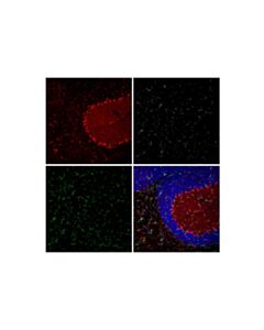 Cell Signaling S100B (E7C3A) Feline Chimeric mAb