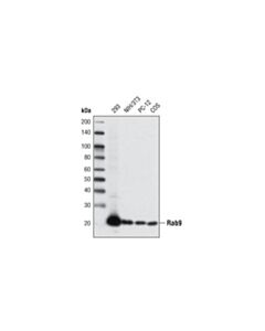 Cell Signaling Rab9a (D52g8) Xp Rabbit mAb