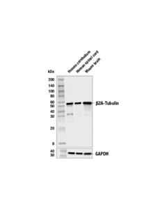 Cell Signaling Beta2a-Tubulin Antibody