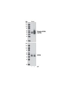 Cell Signaling Phospho-Cd79a (Tyr182) Antibody