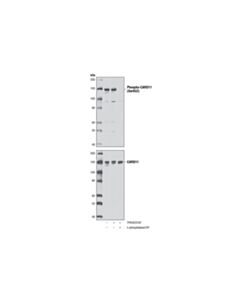 Cell Signaling Phospho-Card11 (Ser652) Antibody