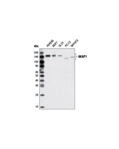 Cell Signaling Akap1 (D9c5) Xp Rabbit mAb
