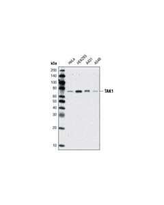 Cell Signaling Tak1 (D94d7) Rabbit mAb