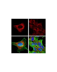 Cell Signaling Calreticulin (D3e6) Xp<LT/>Sup&Gt;®<LT/>/Sup&Gt; Rabbit mAb (Alexa Fluor<LT/>Sup&Gt;®<LT/>/Sup&Gt; 555 Conjugate)