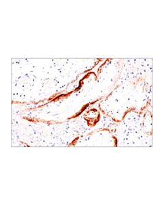 Cell Signaling Sars-Cov-1/2 Spike Protein (2b3e5) Mouse mAb