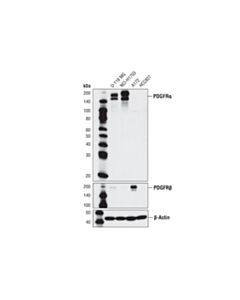 Cell Signaling Pdgf Receptor Alpha (D13c6) Xp Rabbit mAb