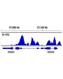Cell Signaling Ezh2 (D2c9) Xp<LT/>Sup&Gt;®<LT/>/Sup&Gt; Rabbit mAb