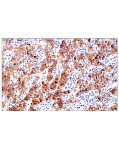 Cell Signaling FGF Receptor 2IIIb (FPR2-D) Mouse mAb