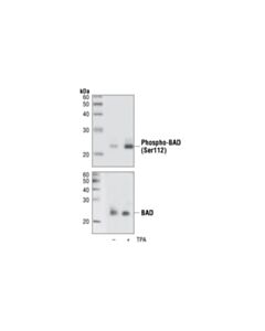 Cell Signaling Phospho-Bad (Ser112) (40a9) Rabbit mAb
