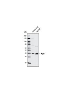Cell Signaling Adh1 Antibody