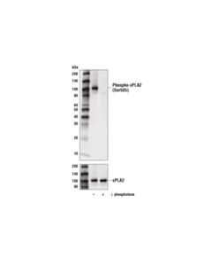 Cell Signaling Phospho-Cpla2 (Ser505) (D4i2a) Rabbit mAb