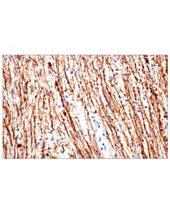 Cell Signaling Neurofilament-M (E7y8w) Mouse mAb