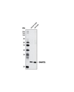 Cell Signaling SNAP25 (D7B4) Rabbit mAb 20 uL