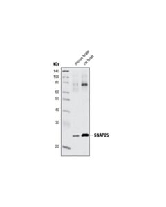 Cell Signaling Snap25 (D9a12) Rabbit mAb