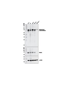 Cell Signaling Merlin/Ezrin/Radixin/Moesin (D1P8I) Rabbit mAb (BSA and Azide Free)